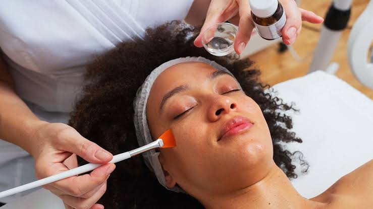 Chemical Peeling in Ahmedabad – Medical-Grade Skin  Renewal for Acne, Pigmentation & Texture